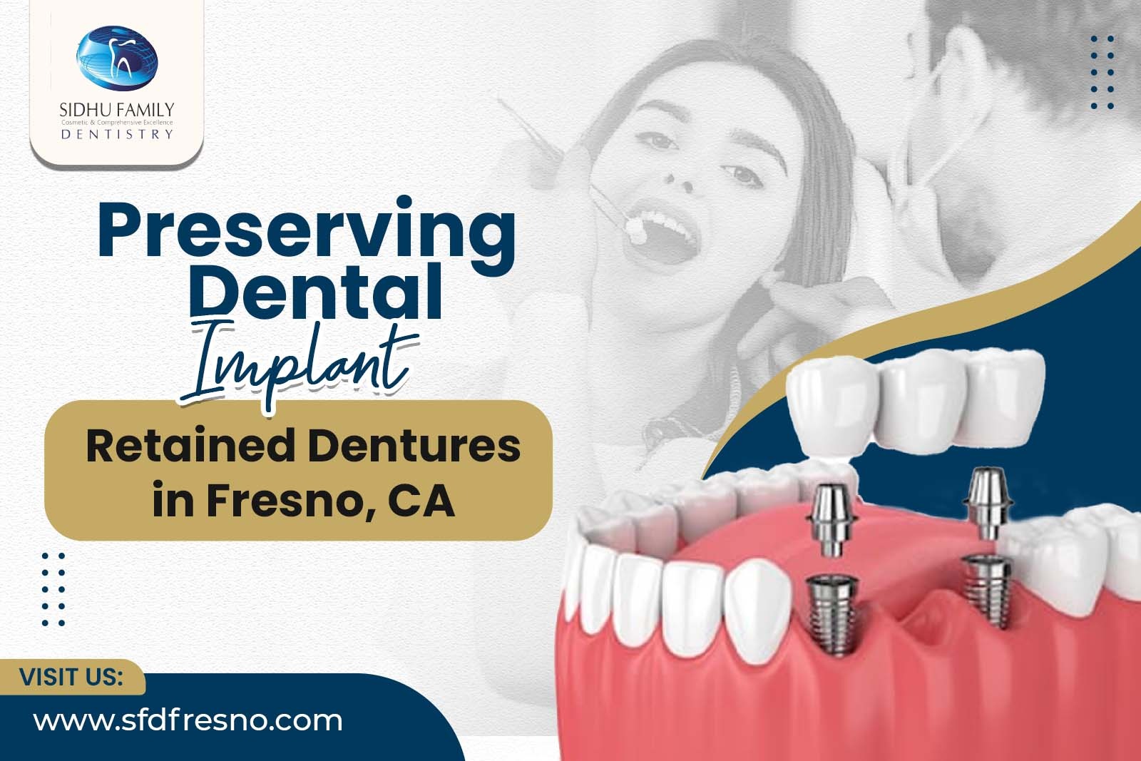 Dental Implant-Retained Dentures in Fresno CA