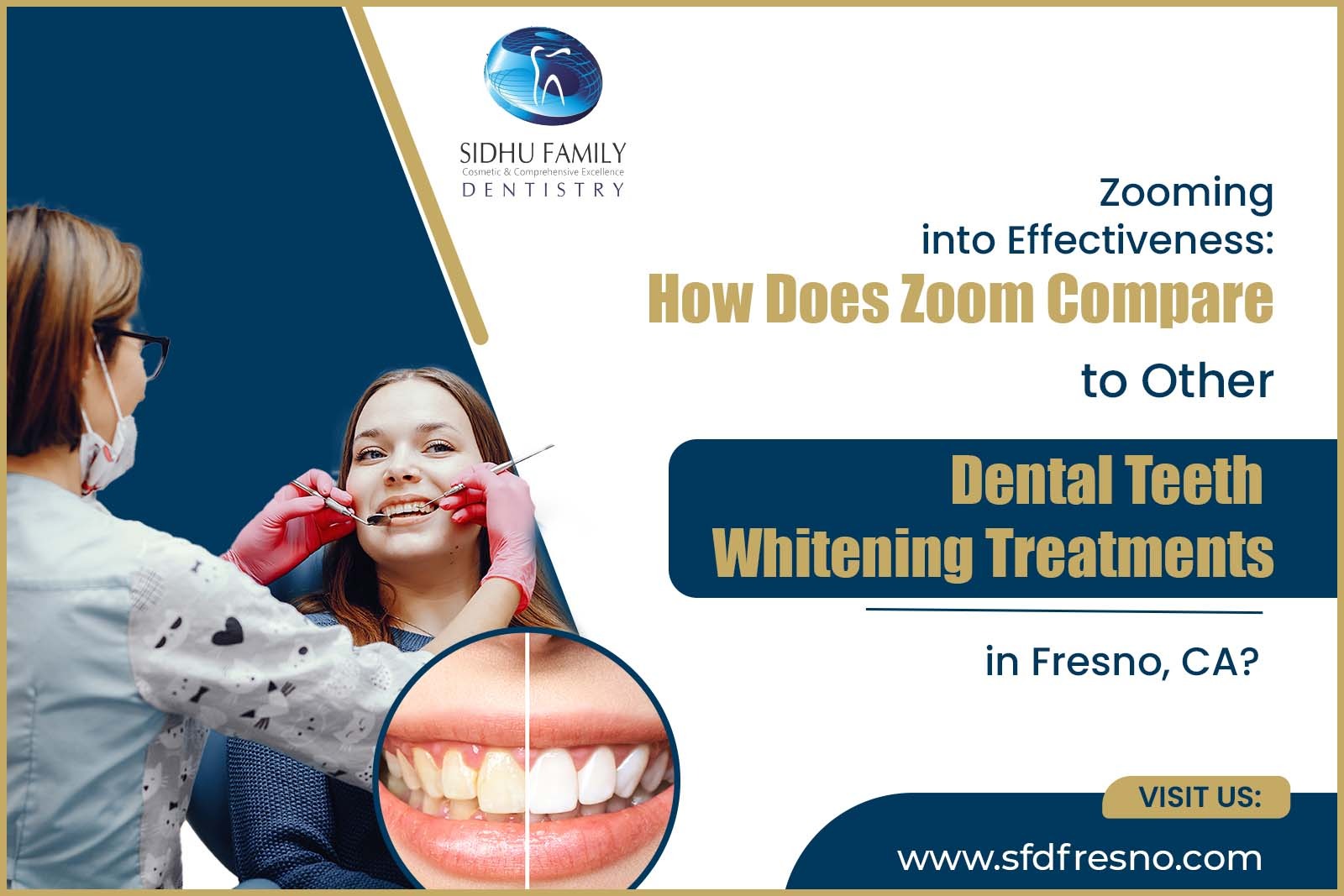 Dental Teeth Whitening Treatments in Fresno, CA