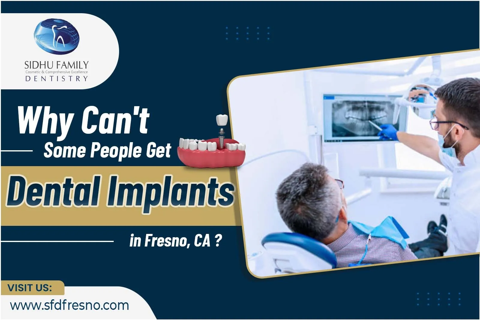 Dental Implants in Fresno, CA