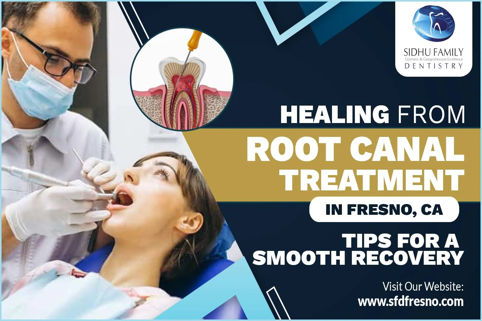 Root Canal Treatment in Fresno, CA