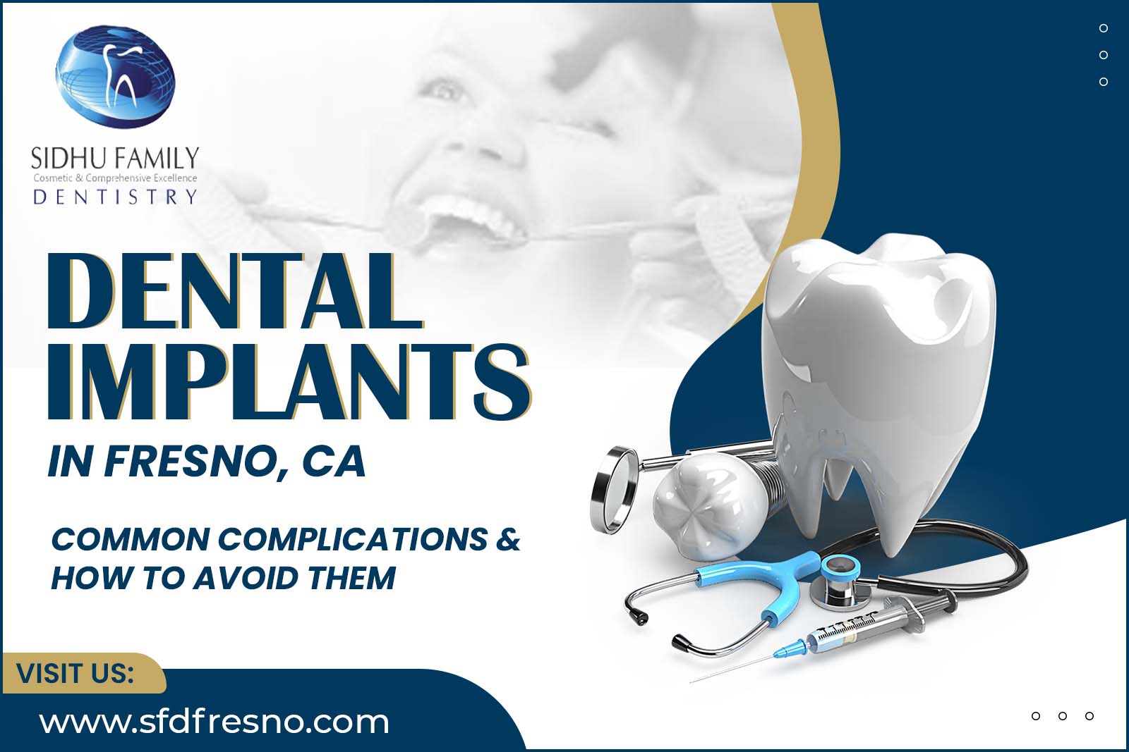 Dental Implants in Fresno, CA