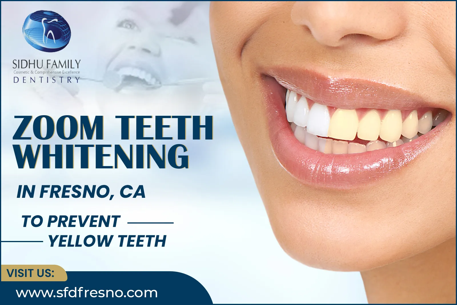 Zoom Teeth Whitening in Fresno, CA