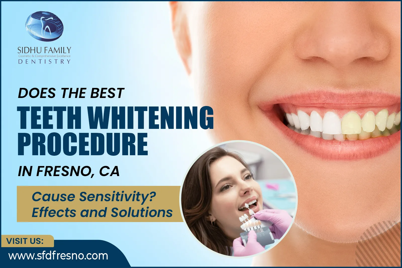 Best Teeth Whitening Procedure in Fresno, CA