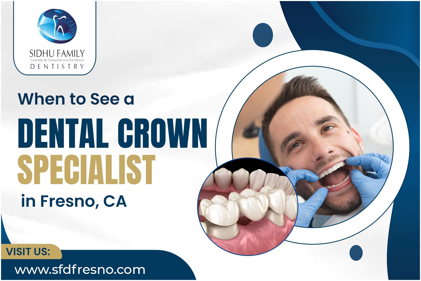 Dental Crown Specialist in Fresno