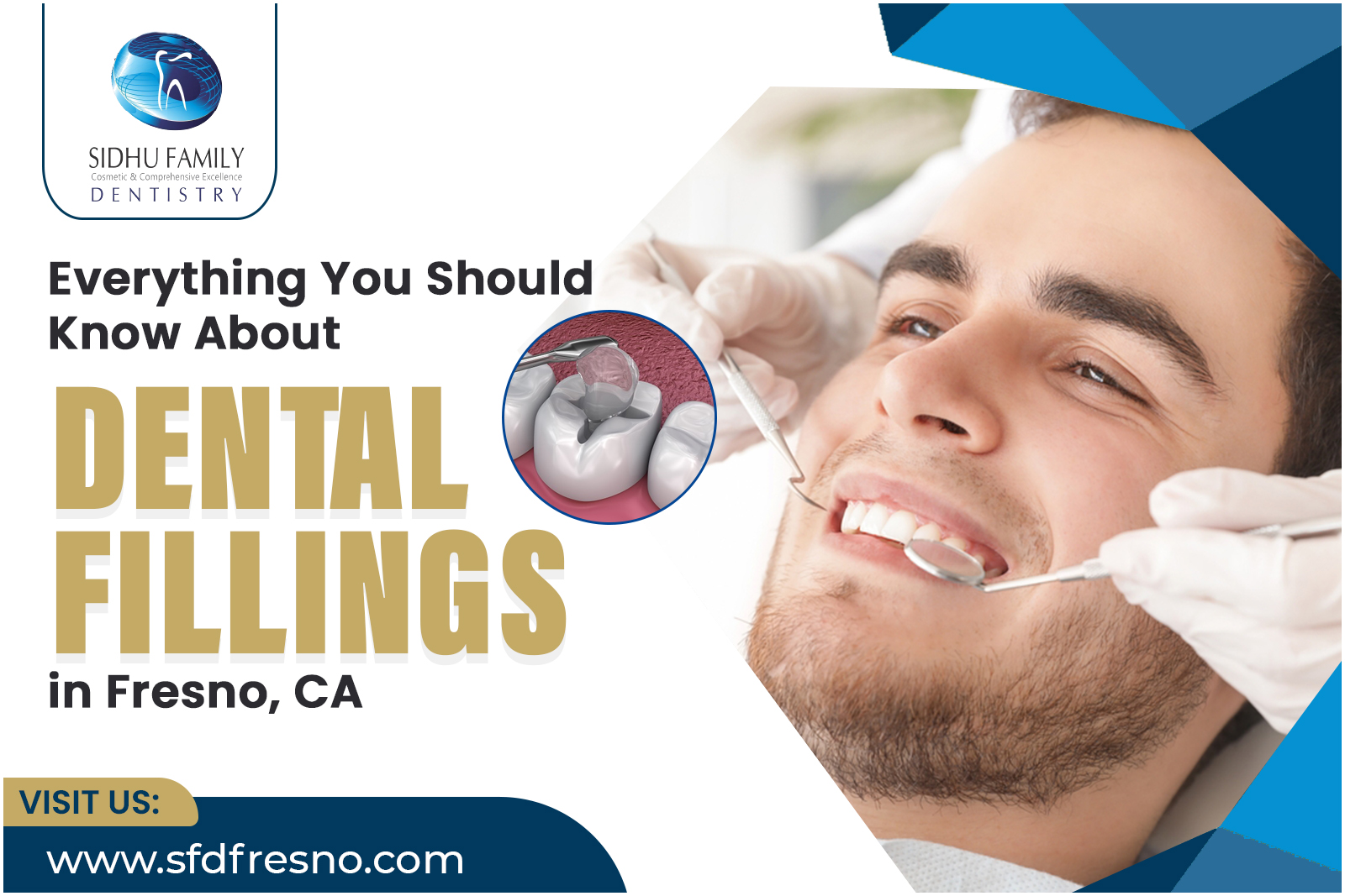 Missing Teeth Replacement in Fresno, CA