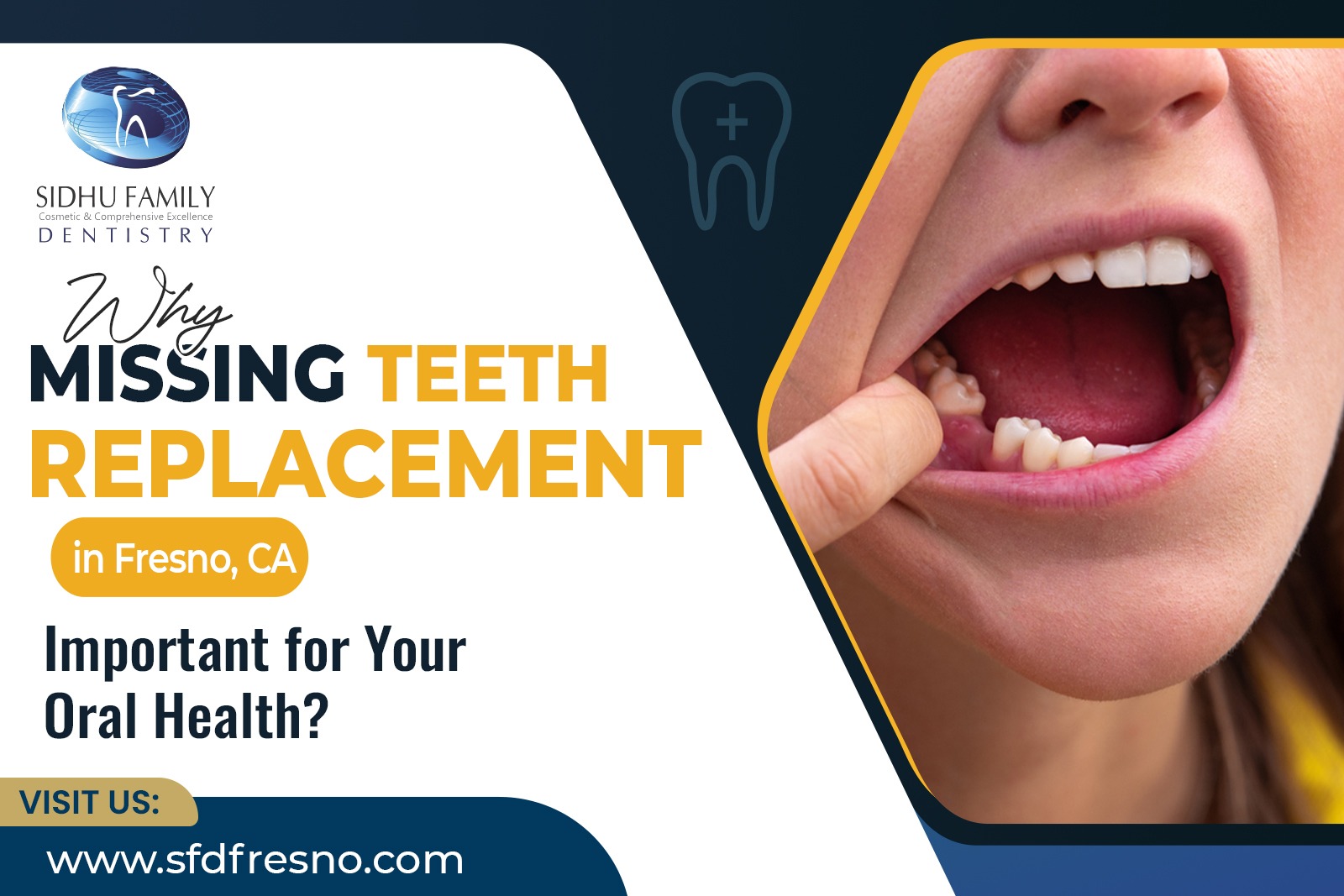 Missing Teeth Replacement in Fresno, CA