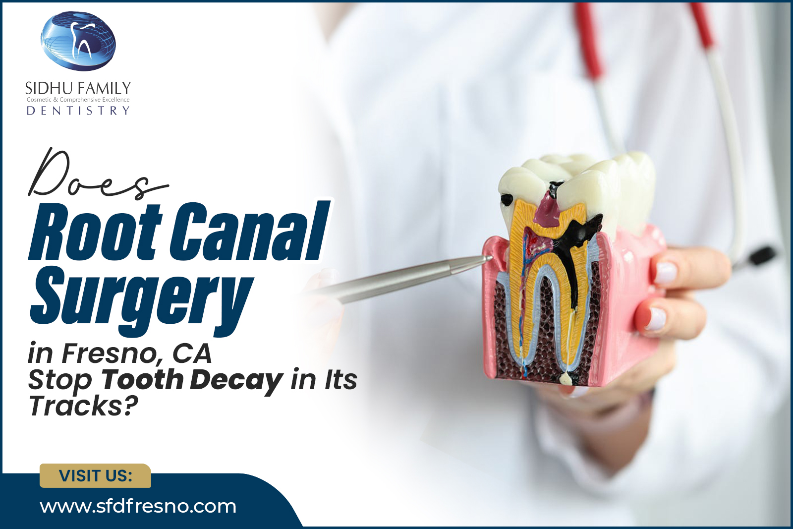 Root Canal Surgery in Fresno, CA