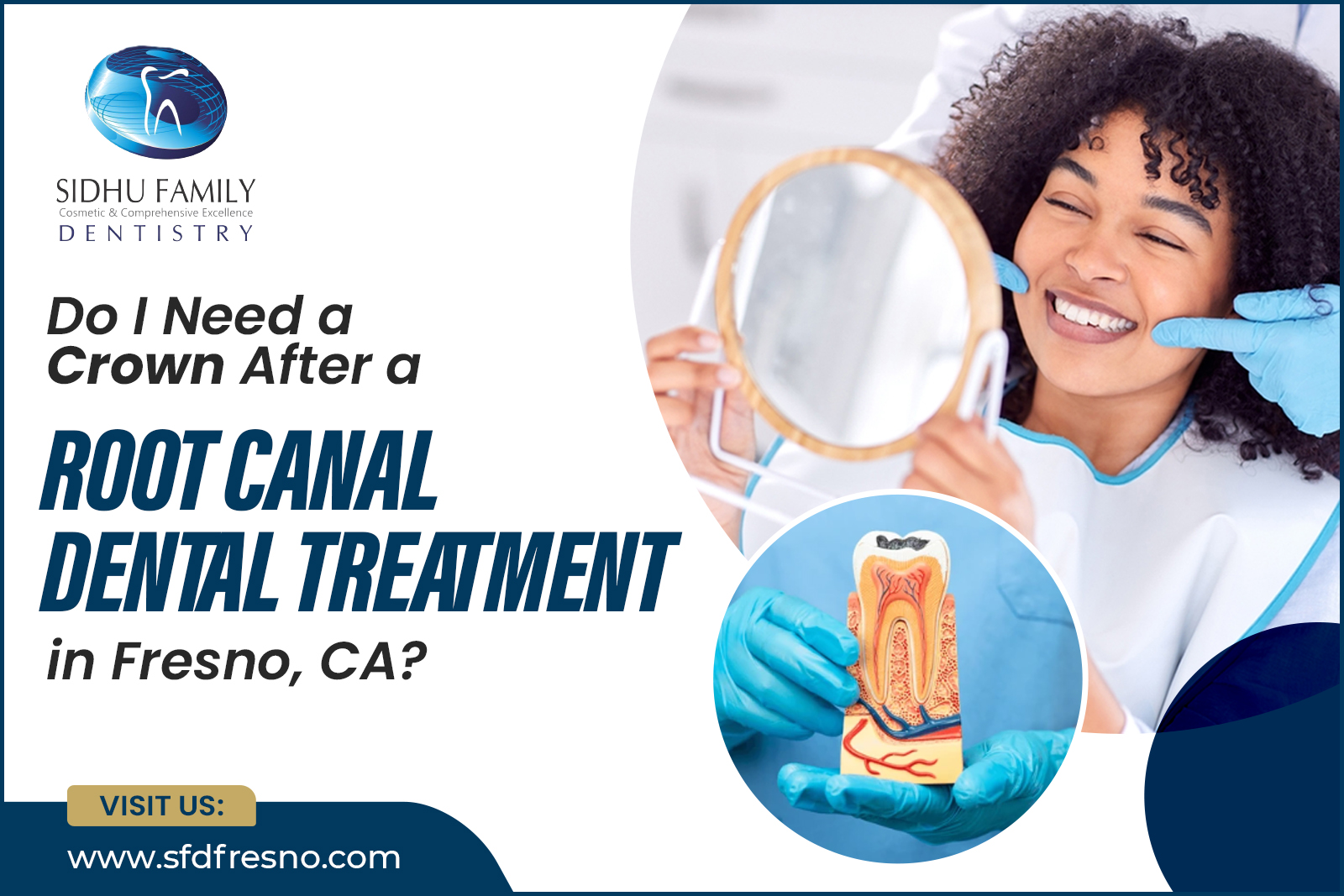 Root Canal Dental Treatment in Fresno, CA