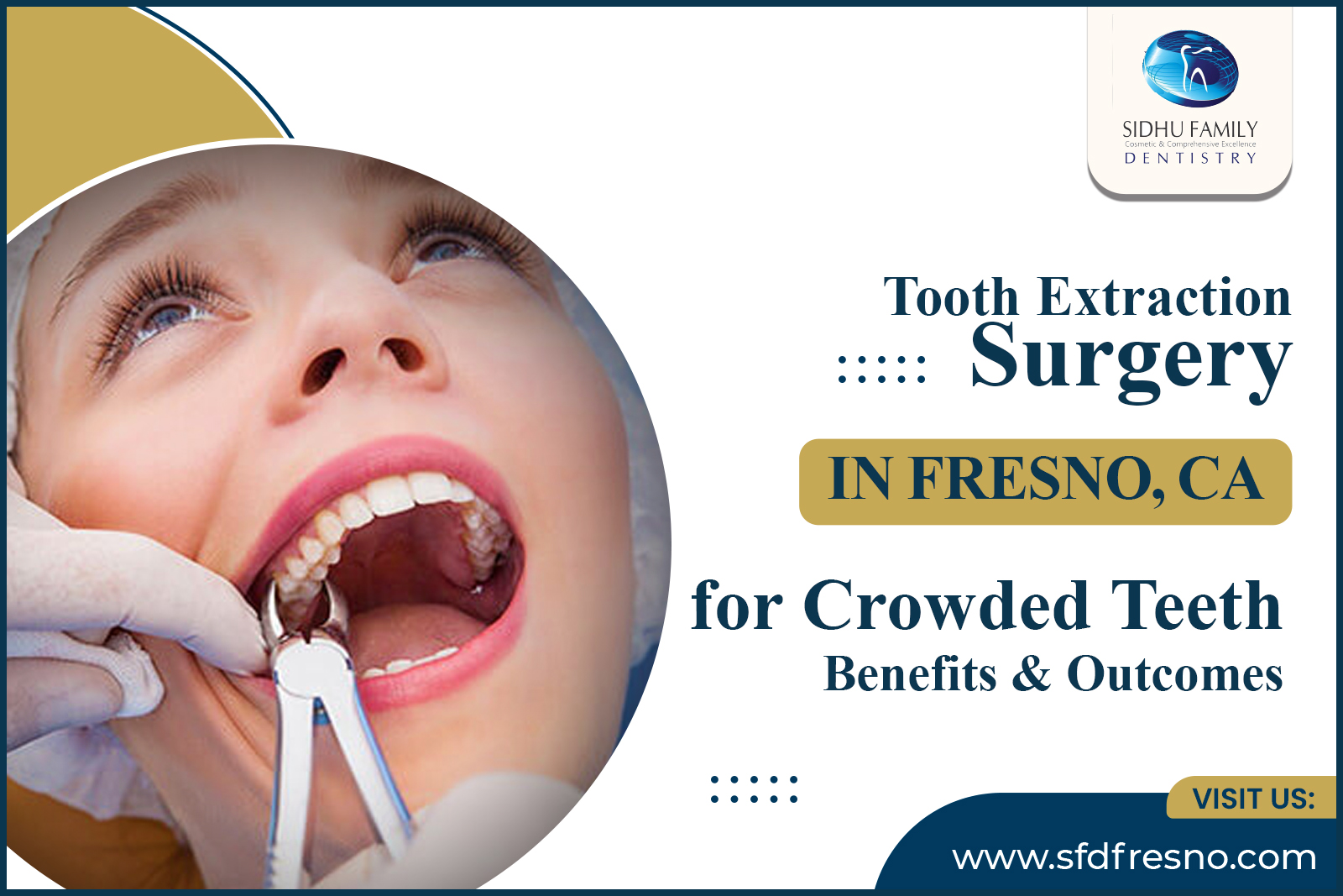 Tooth Extraction Surgery in Fresno, CA