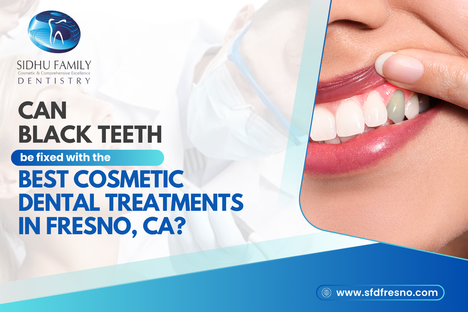 Dental Checkups in Fresno, CA