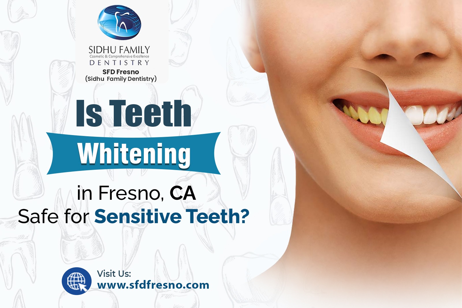 Teeth Whitening in Fresno CA
