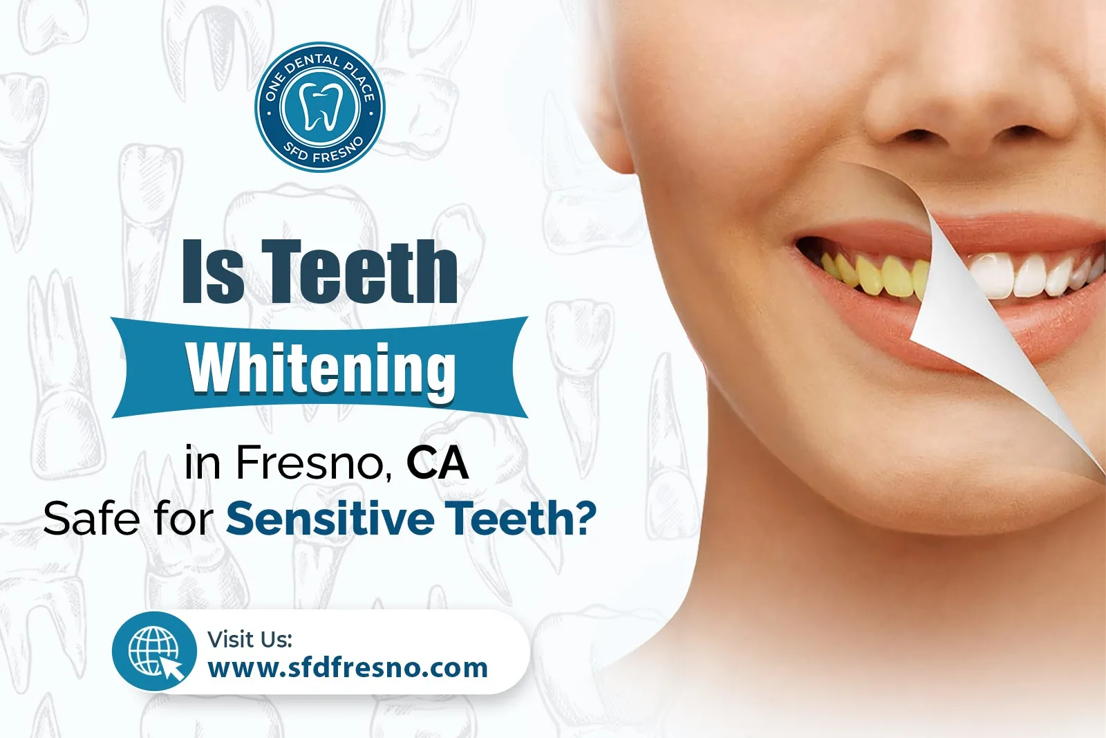 Teeth Whitening in Fresno CA