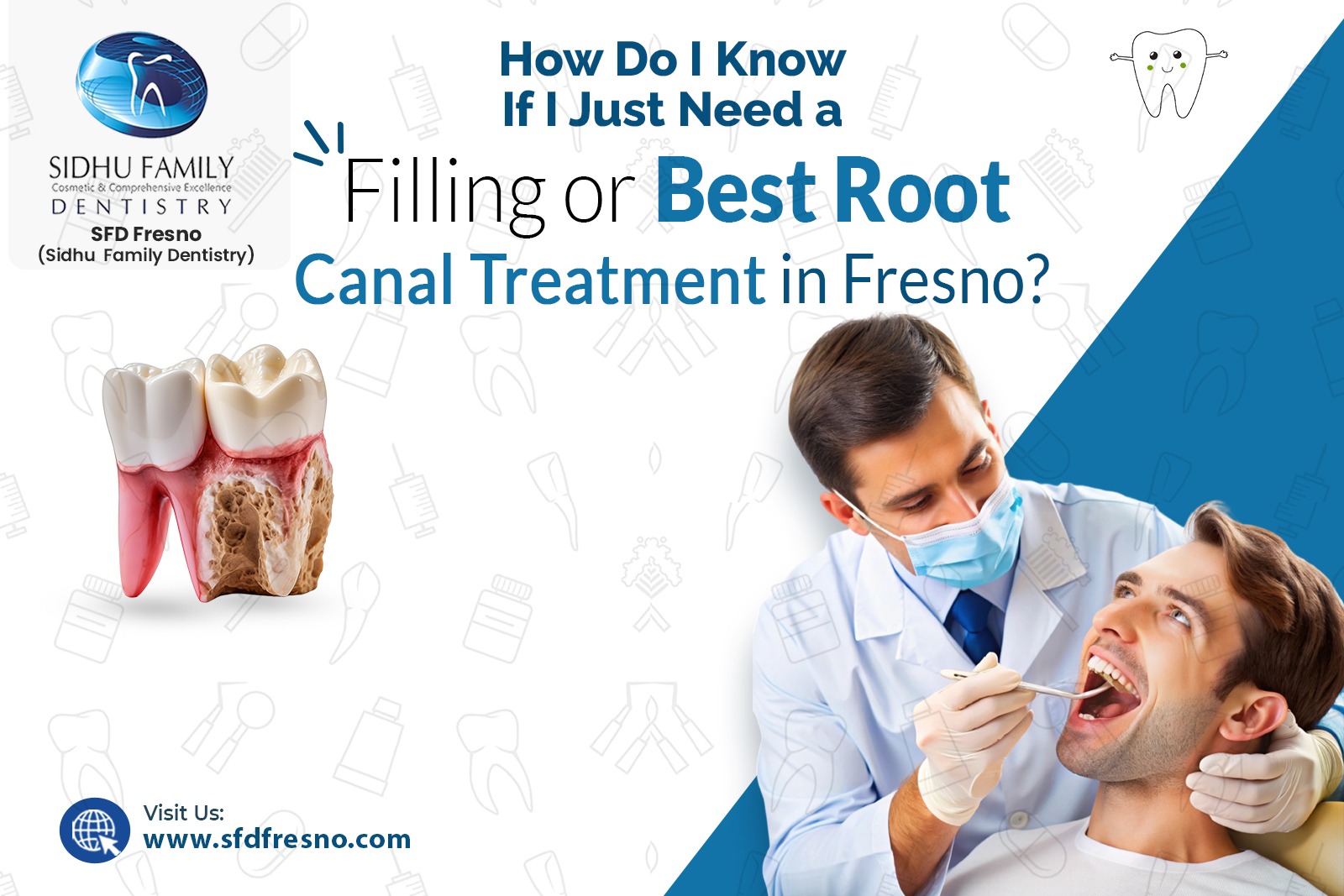 Best Root Canal Treatment in Fresno