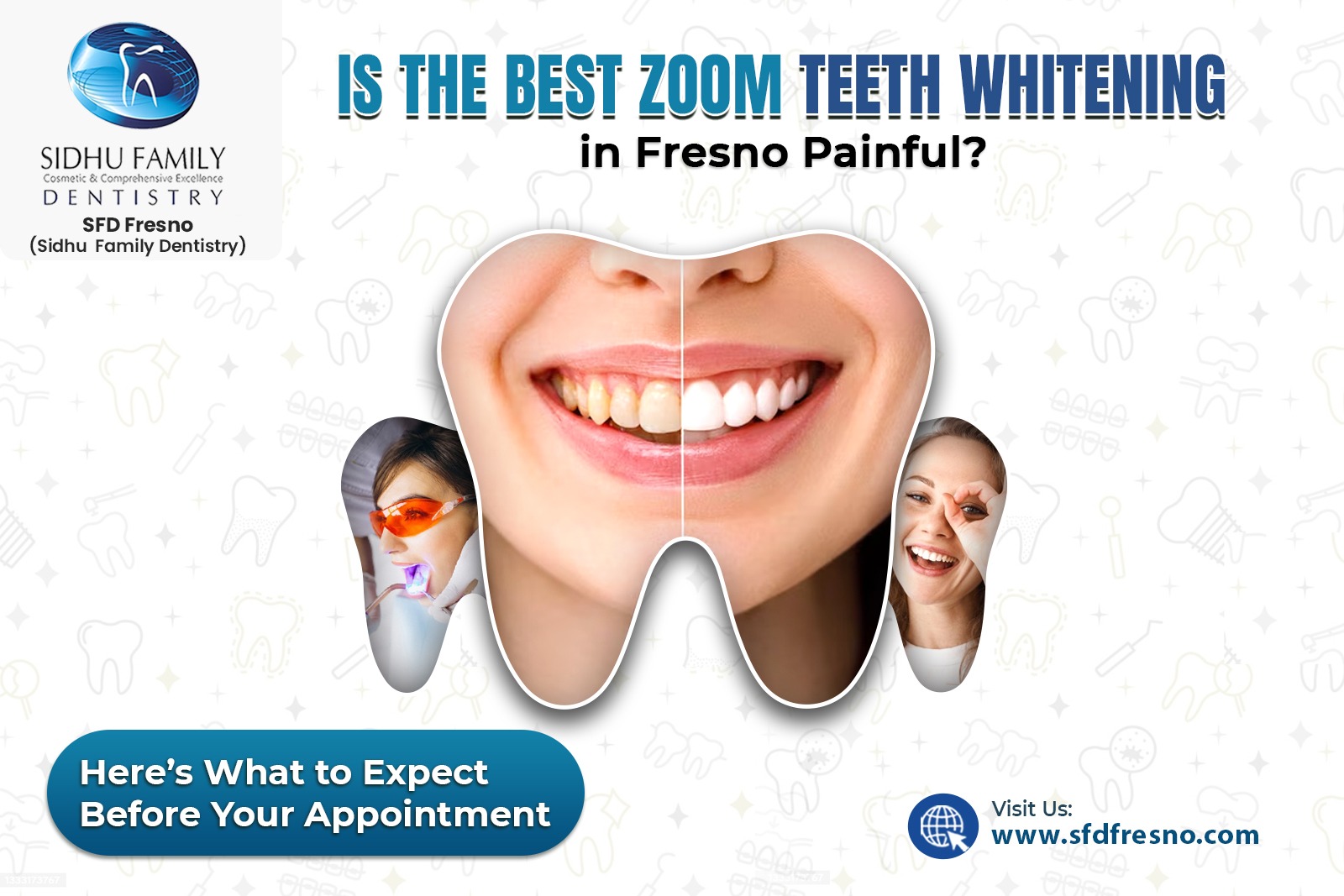 Best Zoom Teeth Whitening in Fresno