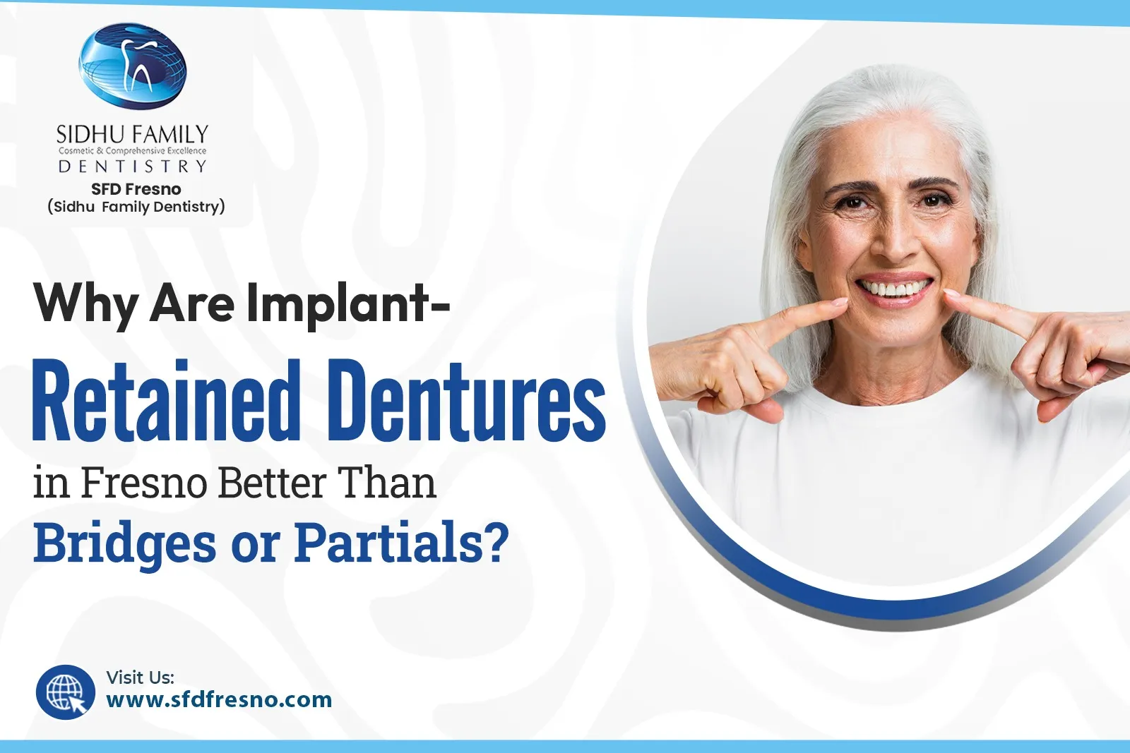 Implant Retained Dentures in Fresno