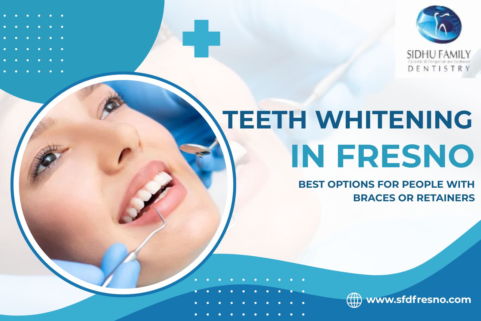 Implant Teeth Whitening in Fresno