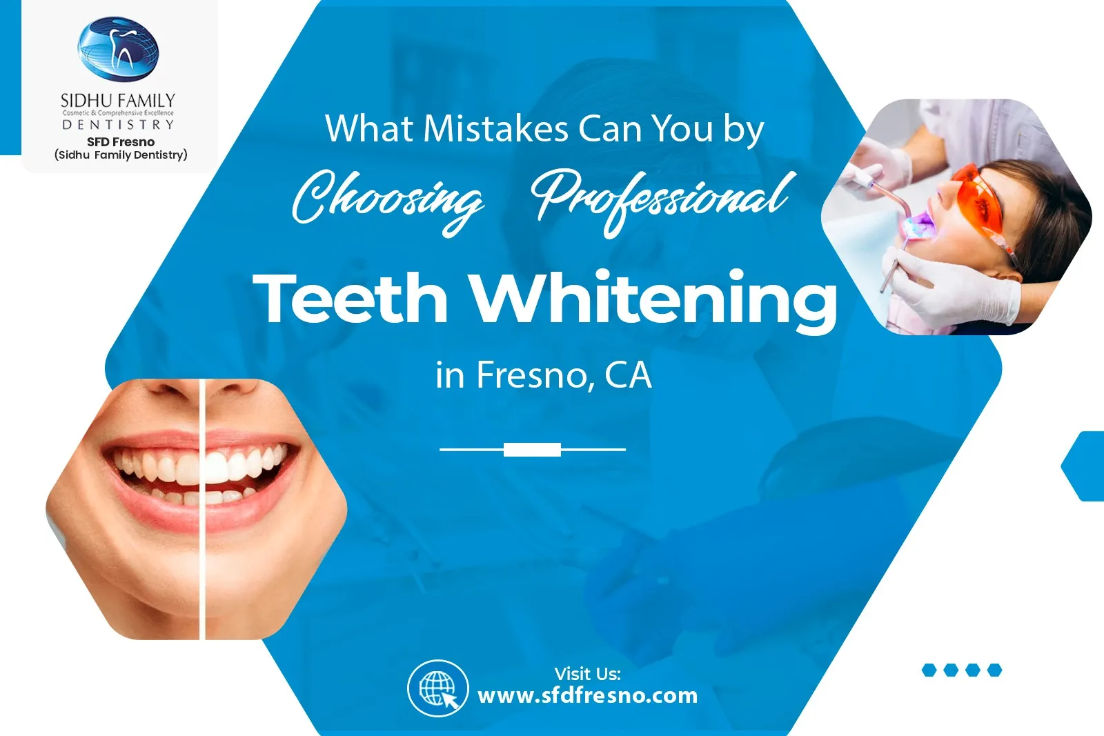 Teeth Whitening in Fresno, CA