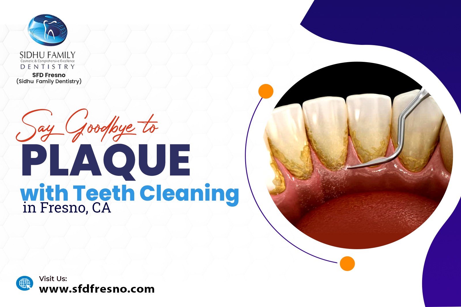 Teeth Cleaning in Fresno, CA
