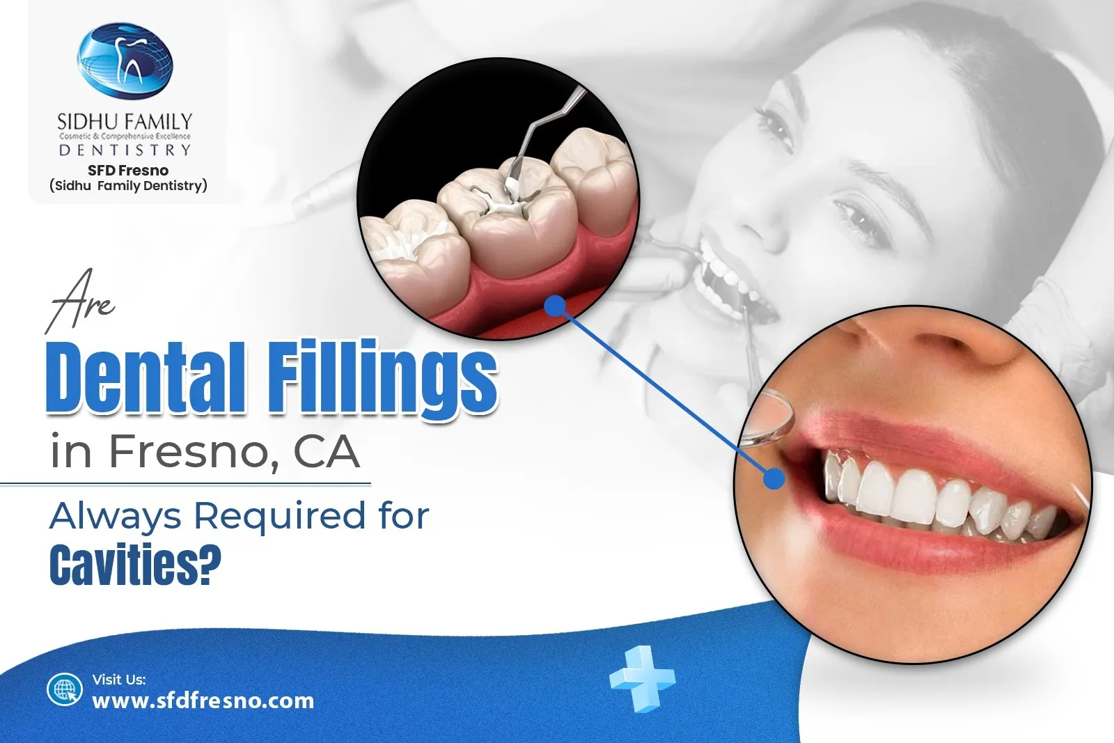 Dental Fillings in Fresno, CA