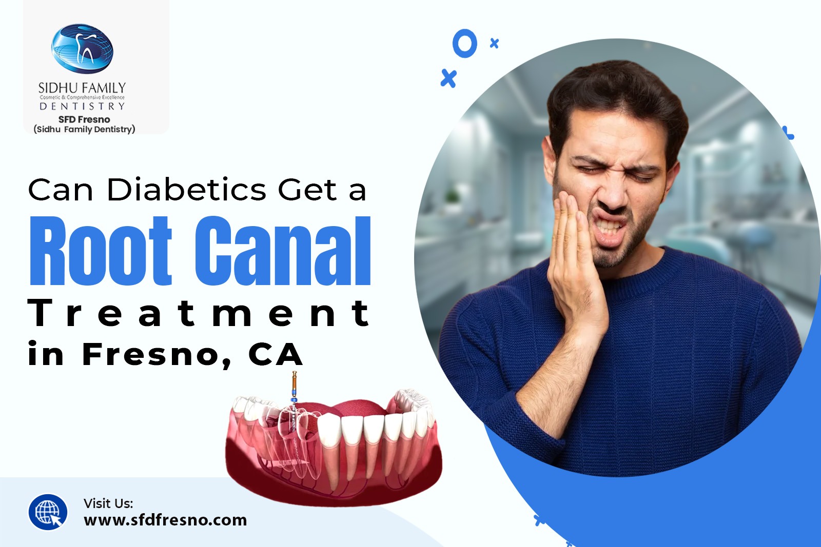 Root Canal Treatment in Fresno, CA