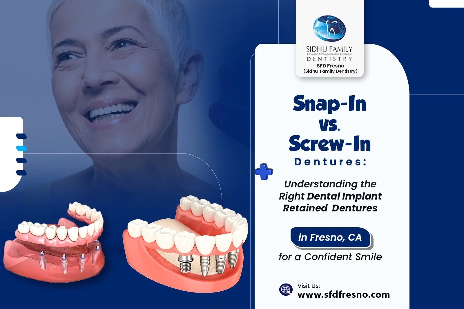 Dental Implant Retained Dentures in Fresno, CA