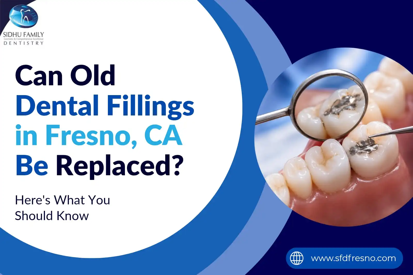Dental Fillings in Fresno, CA