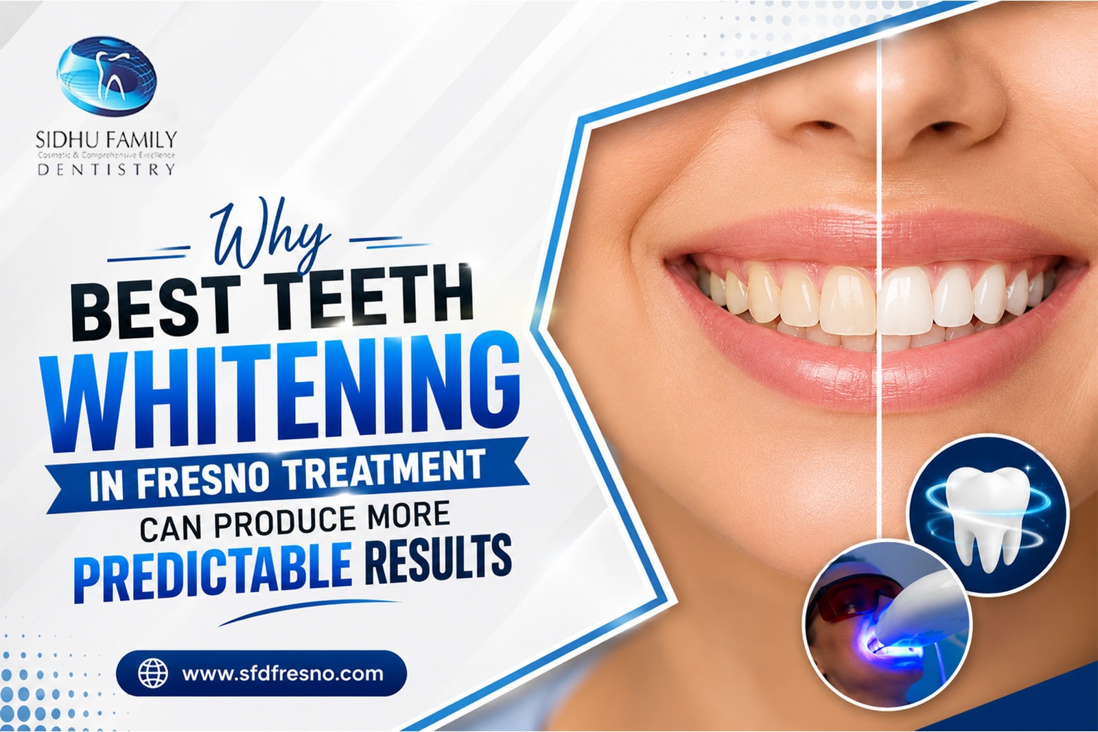 Best Teeth Whitening in Fresno CA